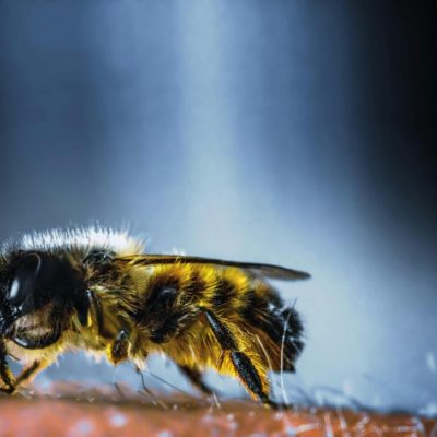 110 άτομα έχουν ήδη νοσηλευτεί μετά από τσιμπήματα σφήκας