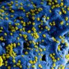SOS από εμπειρογνώμονες: Ο ιός H5N1 εξαπλώνεται και προειδοποιούν για νέα πανδημία